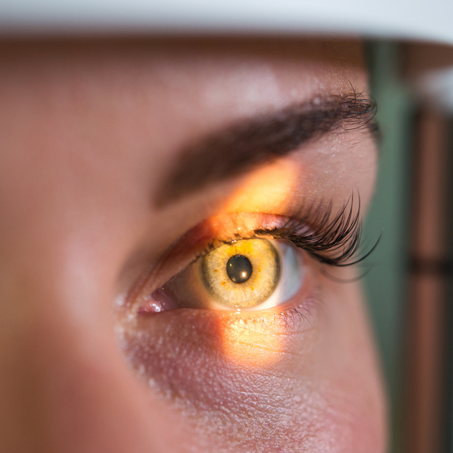 Vision Therapy in Orlando