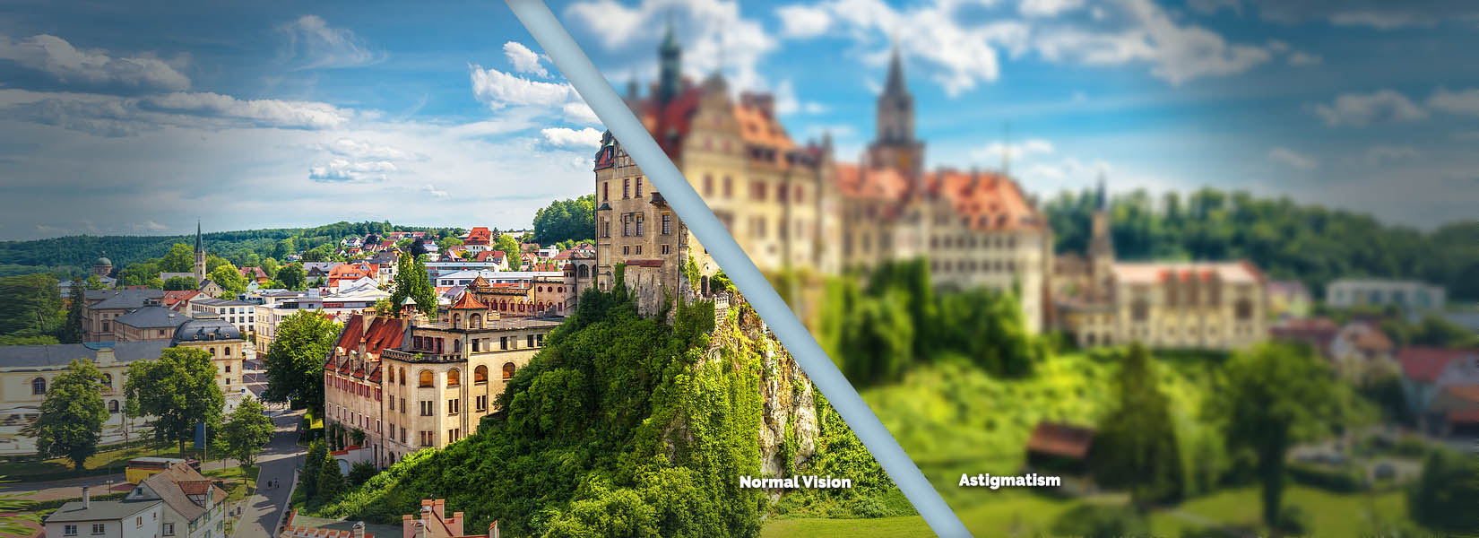 Astigmatism Treatment in Orlando