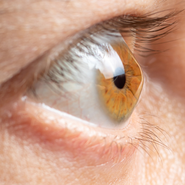 close-up of contact in eye